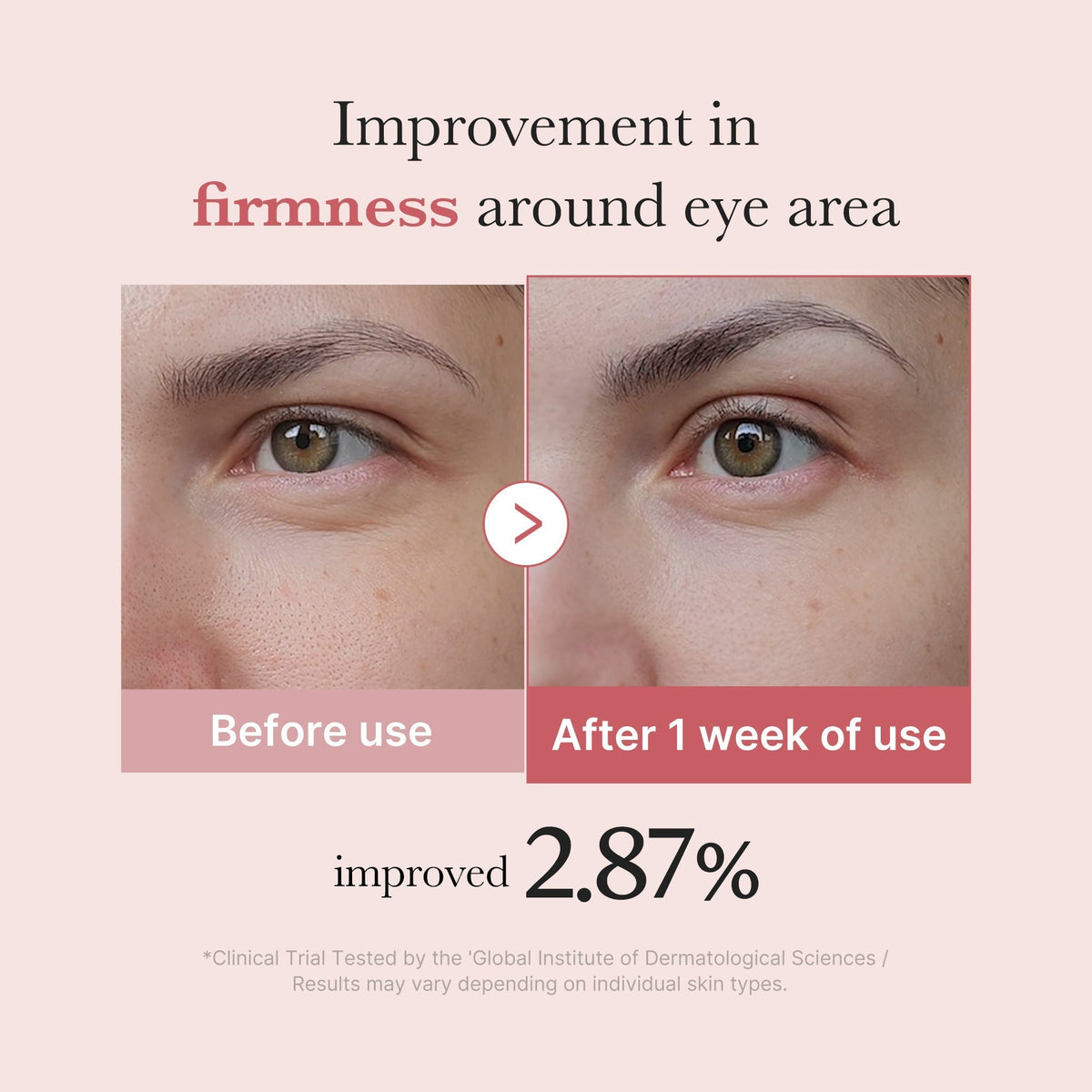 PDRN Pink Peptide Eye Cream - Medicube