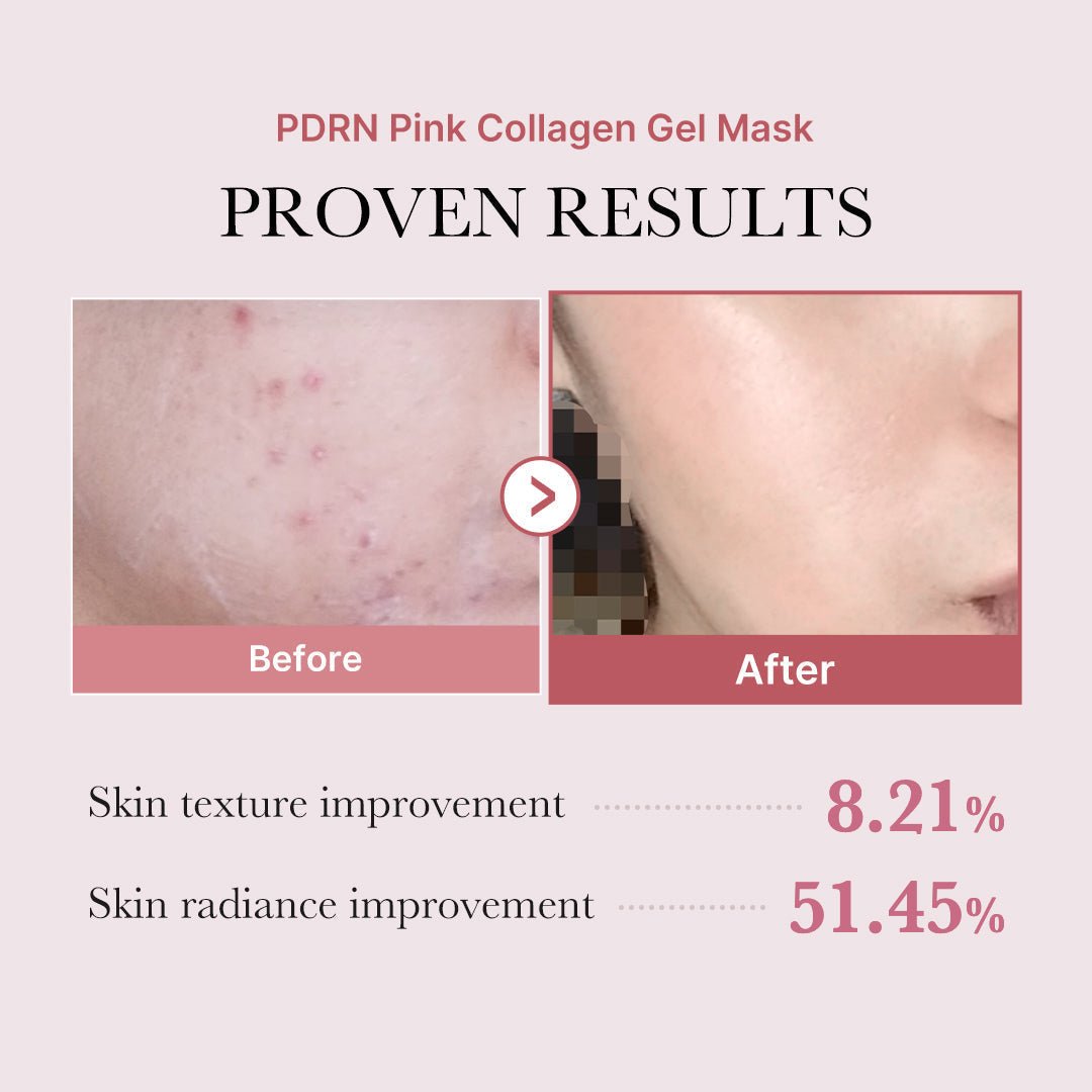 Glass Glow 3-Step Set — Zero Pore Pad + PDRN Serum + Collagen Gel Mask - Medicube