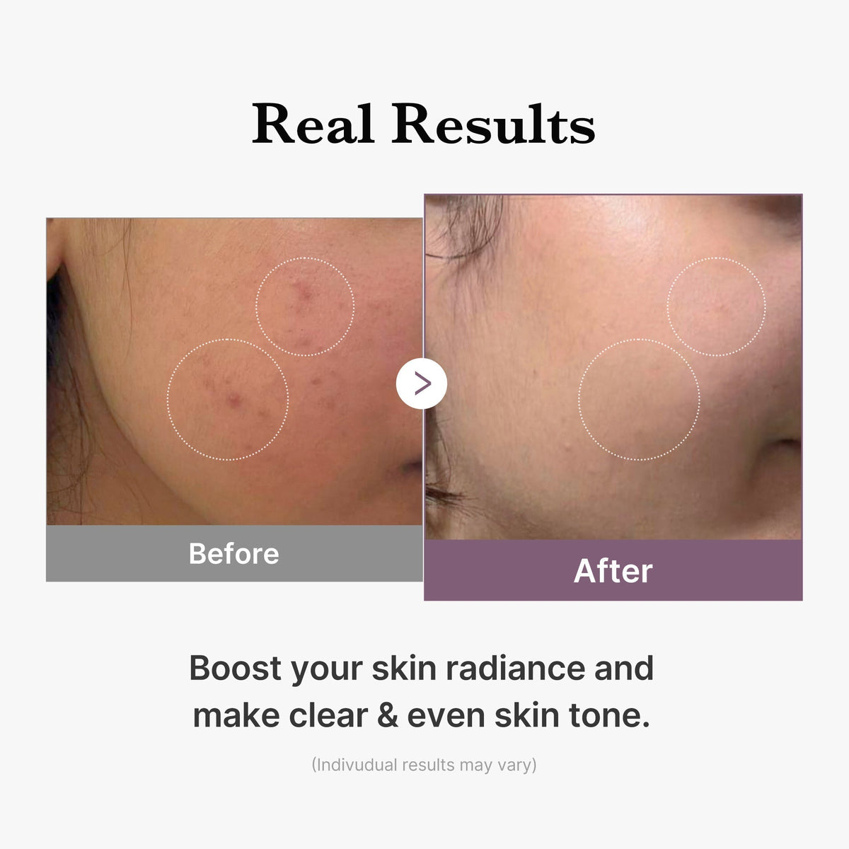 AGE-R Glutathione Glow Milk Toner - Medicube