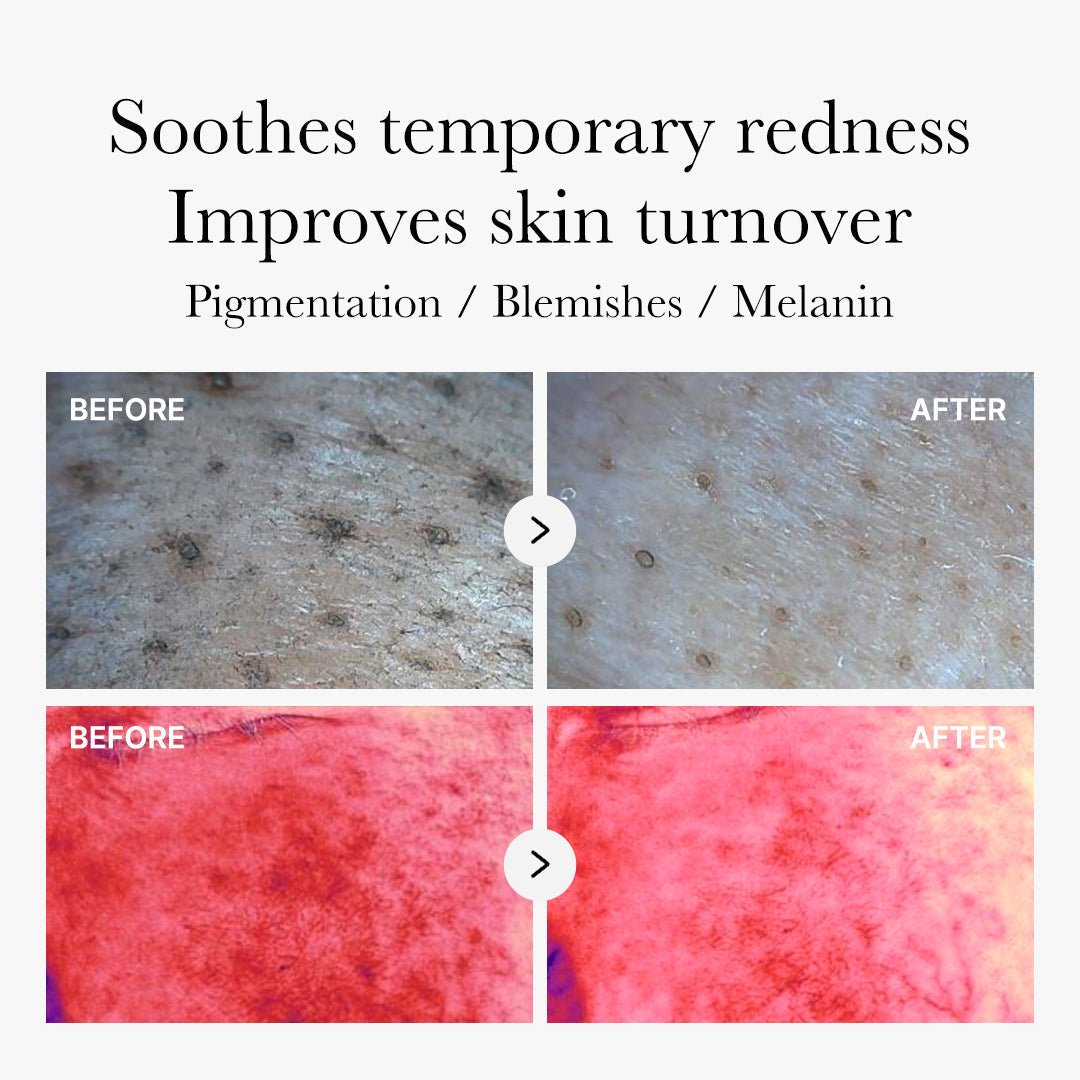 Red Succinic Acid Panthenol Pads - Medicube