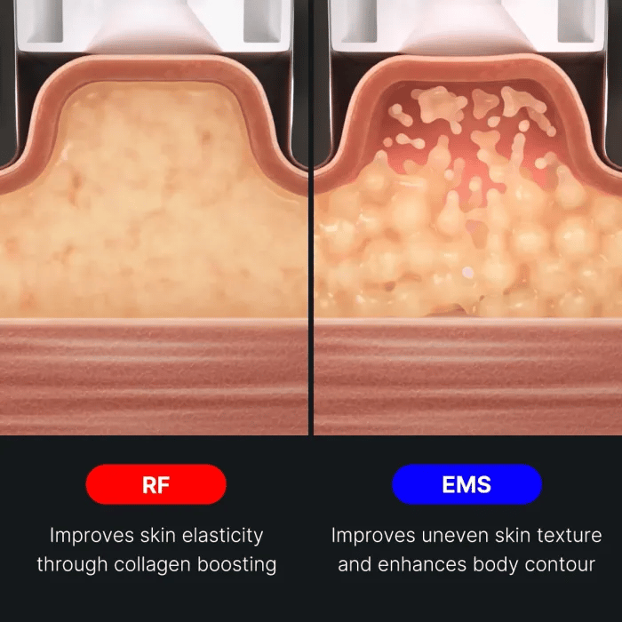 AGE-R Contour Body Shot - Medicube