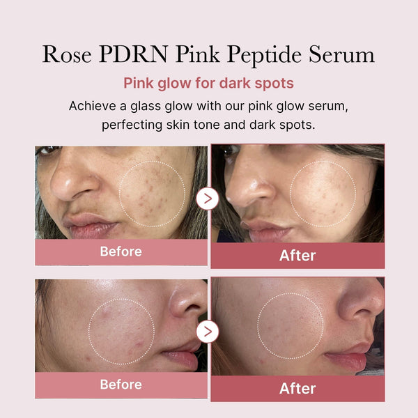Strengthens Skin Barrier